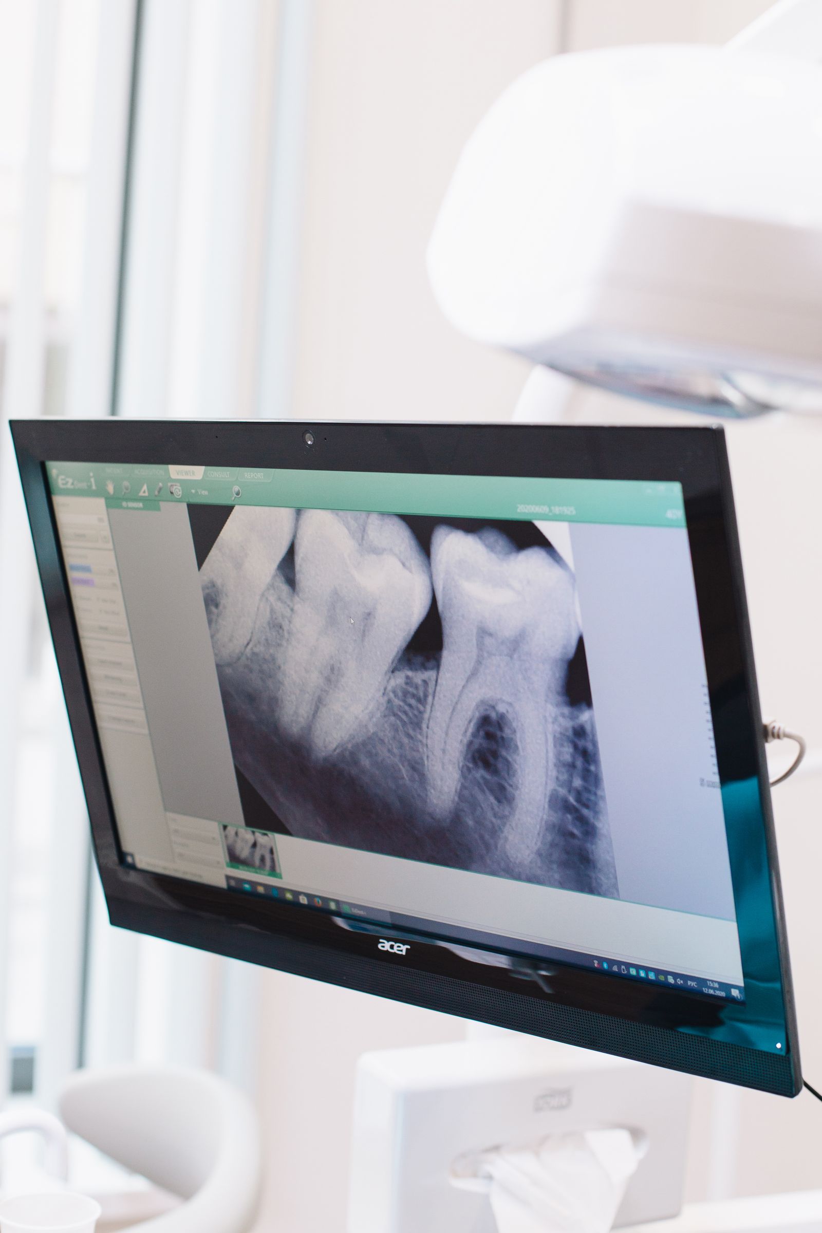 Digitale Aufnahme für die kieferorthopädische Diagnostik